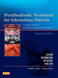 Prosthodontic Treatment for Edentulous Patients: Complete Dentures and Implant-Supported Prostheses