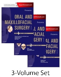 Oral and Maxillofacial Surgery - Expert Consult Three-Volume Set