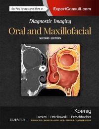 Diagnostic Imaging: Oral and Maxillofacial - Expert Consult