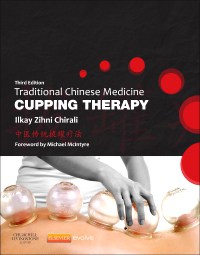 Traditional Chinese Medicine Cupping Therapy