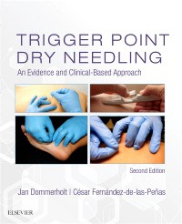 Trigger Point Dry Needling: An Evidence and Clinical-Based Approach