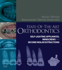 State-of-the-Art Orthodontics: Self-Ligating Appliances, Miniscrews, and Second Molar Extractions