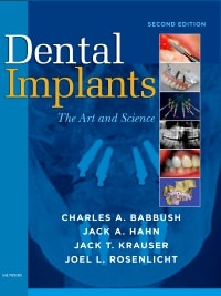 Dental Implants: The Art and Science
