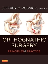 Orthognathic Surgery: Principles & Practice - Two-Volume Set